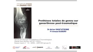 7  PTG sur gonarthrose post traumatique [upl. by Htennaj]