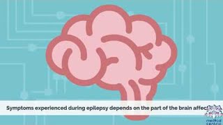 EPILEPSY Causes Signs and Symptoms Diagnosis and Treatment [upl. by Eralc14]