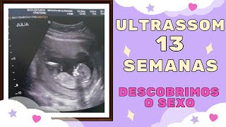 ULTRASSOM 13 SEMANAS  É MENINO OU MENINA 🤰🏻 EXAME DE TRANSLUCÊNCIA NUCAL [upl. by Capp]