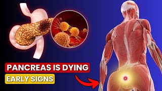 6 Symptoms of PANCREATIC CANCER That Will SHOCK YOU  Critical Warning Signs [upl. by Araf]