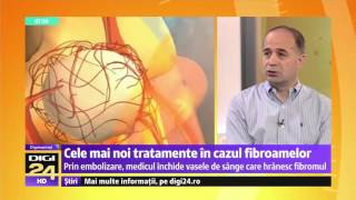 ARES  Digimatinal  Doctor Rares Nechifor  Despre Procedura de Embolizare a Fibromului Uterin [upl. by Bodnar113]