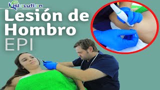 TRATAMIENTO EPI del HOMBRO LESIONADO Fisioterapia  Fisiolution [upl. by Ardnoid875]