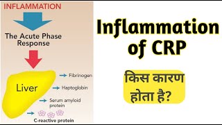 Inflammation in hindi  what is inflammation  Inflammation [upl. by Barayon]