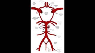 INFARTO LACUNAR [upl. by Rochus]