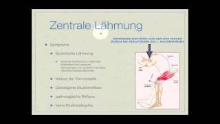 Basiskurs Neurologie Lähmungen Teil 214 [upl. by Samaj383]