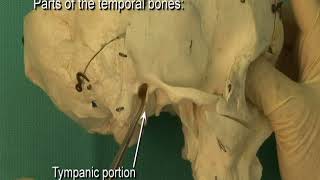 17 Step 1 Parts of the adult temporal bone petrotympanic fissure [upl. by Namad863]