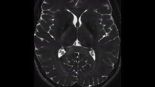 T2 Axial Cranial Nerves from Imaging Anatomy of the Human Brain [upl. by Dodie]