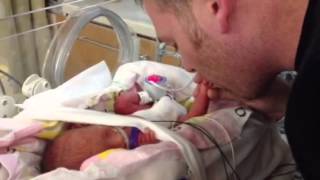 Preemie born at 27 weeks plays with her Daddy [upl. by Damiani684]