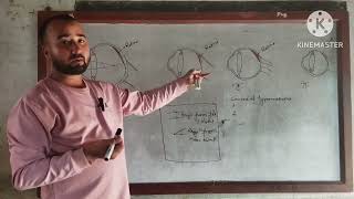 Class10 Science Myopia and Hypermetropia with their Correction [upl. by Thomey]