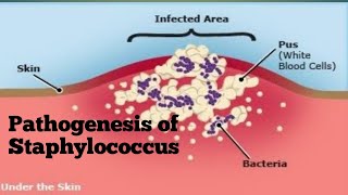 Pathogenesis of Staphylococcus [upl. by Nyrrat540]