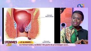 Hémorroïdes  symptômes et causes  on en parle dans Les Femmes dIci [upl. by Ainola267]