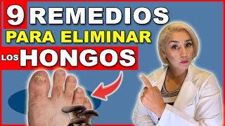 ¡Elimina HONGOS en las UÑAS en 24 HORAS  9 REMEDIOS NATURALES para HONGOS en las UÑAS 😲 [upl. by Ived]