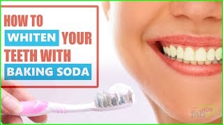 How to Whiten Teeth Instantly with Baking Soda Correct Procedure [upl. by Emmer]