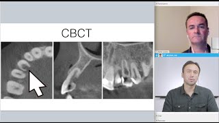 Case Report Cervical Root Resorption with Dr Adrian Lozano [upl. by Jeraldine]