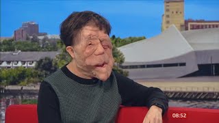 A Different Man ADAM PEARSON interview 2024 [upl. by Amliw955]