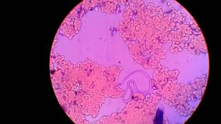 Live MicrofilariaParasite In Blood Under Microscope Captured In My Camera [upl. by Acinoda864]