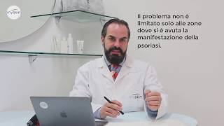 Le cause della Psoriasi [upl. by Anahpos]