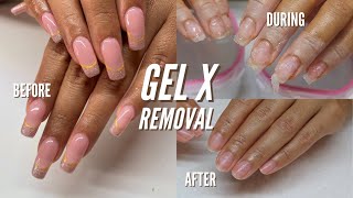 HOW TO REMOVE GEL X NAILS AT HOME [upl. by Eivod]