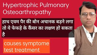 Hypertrophic pulmonary osteoarthropathy causes symptoms diagnosis Treatment pathology [upl. by Nodrog]