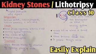 Kidney Stones  Cause Symptoms And Treatment  Lithotripsy  Class 10 Biology [upl. by Disharoon]