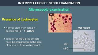 Interpretation of Stool Examination [upl. by Llenna]