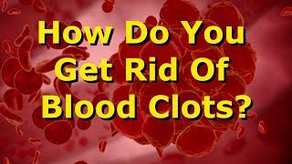 How Do You Get Rid Of Blood Clots [upl. by Nitsud]