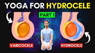 Treat Hydrocele amp Varicocele at Home Part 1  Yoga Exercises for Hydrocele amp Varicocele hydrocele [upl. by Hadden853]