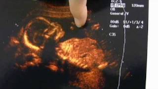 18 Weeks Pregnant Ultrasound Praying Baby [upl. by Gelasius388]