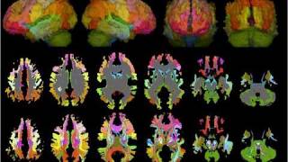 Not grey matter the colourful brain UCL [upl. by Luhey]