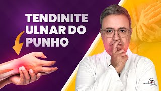 Tendinopatias do Extensor Ulnar do Carpo [upl. by Annekcm551]