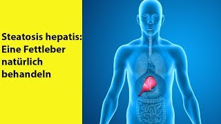 Steatosis hepatis Eine Fettleber natürlich behandeln  Gesundheit [upl. by Player]