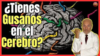 🔴 NEUROCISTICERCOSIS o CISTICERCOSIS CEREBRAL CUANDO LOS GUSANOS INVADEN NUESTRO CEREBRO 🔴 [upl. by Yeuh399]