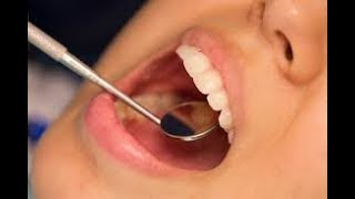 Dental AssistantHIPPAradiologia dentalpreguntas [upl. by Emerick911]