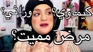 رحلتي مع مرض التصلب المتعدد MS [upl. by Moreen]