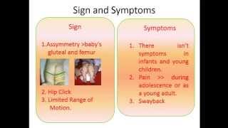 PPT English Congenital Hip Dysplasia [upl. by Maidel110]