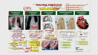 1 MAPA MENTAL DE QX TÓRAX Y CV TRAUMA TORÁCICO [upl. by Wynne]