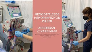 Hemoperfüzyon İşlemiAdsorban Çıkarılması [upl. by Cichocki615]