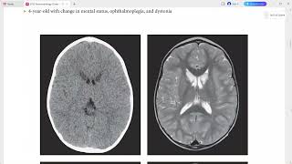 NEURORADIOLOGY OXFORD CASES [upl. by Dunning]