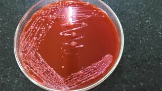 Isolation of Rhizobium on CRYEMA from Root nodules [upl. by Hagile]