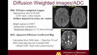 Brain MRI sequences 101 [upl. by Tobit]