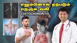 Costochondritis  எலும்பினால் ஏற்படும் நெஞ்சு வலி  Dr Jeya Venkatesh [upl. by Franzoni]