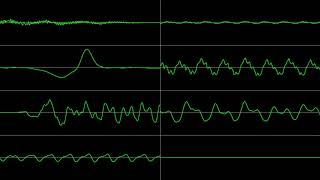 Earthbound Sunrise amp Onett SNES Oscilloscope [upl. by Aihsad]