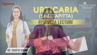 Sanjeevani Naturopathy amp Ayurveda Centre  Urticaria  Sheetapitta  Sun 23 May [upl. by Obbard]