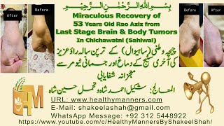 Miraculous Recovery of 53 Years Old Rao Aziz from Last Stage Brain amp Body Tumors In Chichawatni [upl. by Teiluj]