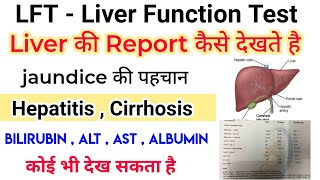 LFT  Liver function test  report कैसे देखे  AST  ALT  Bilirubin  ALP [upl. by Anirehtac202]