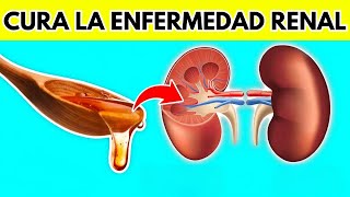 NINGÚN paciente renal volverá a perder un riñón Mira Esto [upl. by Aloin180]