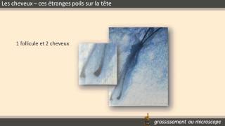 LES CHEVEUX CES ÉTRANGES POILS QUI POUSSENT SUR NOS TETES [upl. by Ialohcin]