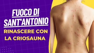 Fuoco di SantAntonio Herpes Zoster  Il rimedio è la Criosauna [upl. by Lzeil613]