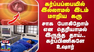 கர்ப்பப்பையில் இல்லாமல் இடம் மாறிய கரு சாக போகிறோம் என தெரியாமல் இருந்த தாய் கர்ப்பிணிகளே உஷார் [upl. by Theran]