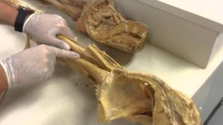 Anatomy Lab  10  Muscle of Lower Limb Part 01 [upl. by Samaj]